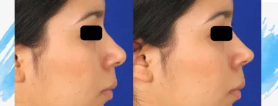 La imagen 3 de la Empresa DR JORGE ALIRIO HOLGUÍN RUIZ Otorrinolaringología en Cali VAC