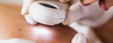 La imagen 4 de la Empresa EMMA REYES OVIEDO Dermatología en Cúcuta NSA