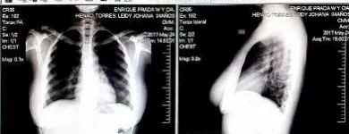 La imagen 1 de la Empresa EPW DIGITAL - ENRIQUE PRADA WINKLER Radiología en Medellín ANT