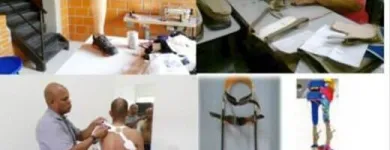 La imagen 5 de la Empresa FABRICA ORTOPÉDICA BRITÁNICA Tienda de suministros médicos en Cali VAC