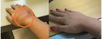 La imagen 2 de la Empresa MARCELA BONILLA FISIOTERAPEUTA TERAPIA FÍSICA INTEGRAL Spa con masajes en Bogotá, D.c. DC