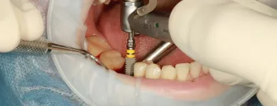 La imagen 2 de la Empresa MARIA CAROLINA OLIVEROS M. Odontología en Ibagué TOL
