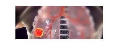 La imagen 3 de la Empresa MAURICIO GONZÁLEZ URREA Médico en Pereira RIS