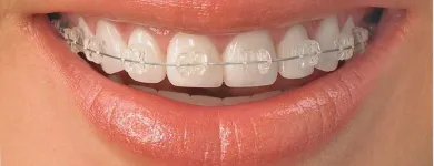 La imagen 2 de la Empresa ODONTIS Ortodoncia en Cali VAC