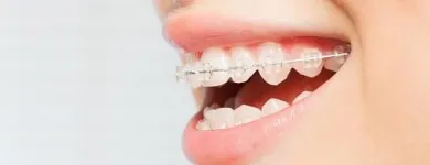 La imagen 4 de la Empresa ORALCLINIC Periodoncista de implantes dentales en Medellín ANT