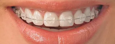 La imagen 5 de la Empresa ORALCLINIC Periodoncista de implantes dentales en Medellín ANT