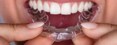La imagen 4 de la Empresa RUBÉN DARIO MENGUAL PÉREZ Periodoncista de implantes dentales en Ibagué TOL