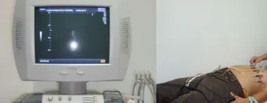 La imagen 3 de la Empresa UNIDAD CARDIOLOGICA Y PERINATAL Cirugía en Neiva HUI