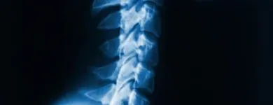 La imagen 2 de la Empresa UNIDAD MÚSCULO ESQUELÉTICA Ortopedia en Medellín ANT