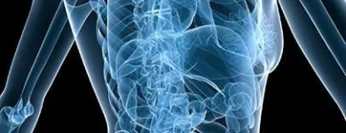 La imagen 5 de la Empresa UNIDAD MÚSCULO ESQUELÉTICA Ortopedia en Medellín ANT