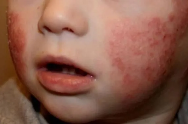 La imagen 2 de la Empresa CLINICA DEL ASMA SANTA CLARA