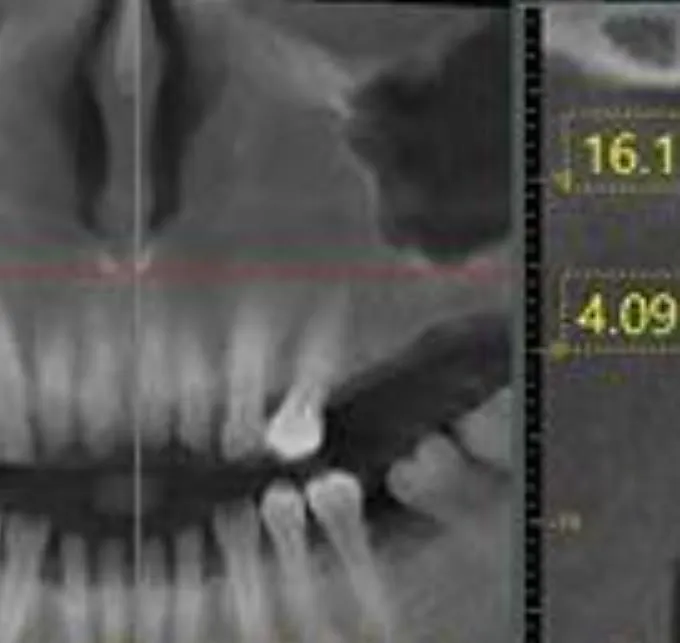 La imagen 1 de la Empresa RADIOLOGIA ORAL CRA SAS